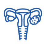 PCOS(PMOS)/PCOD