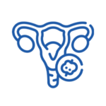 Uterine Fibroids